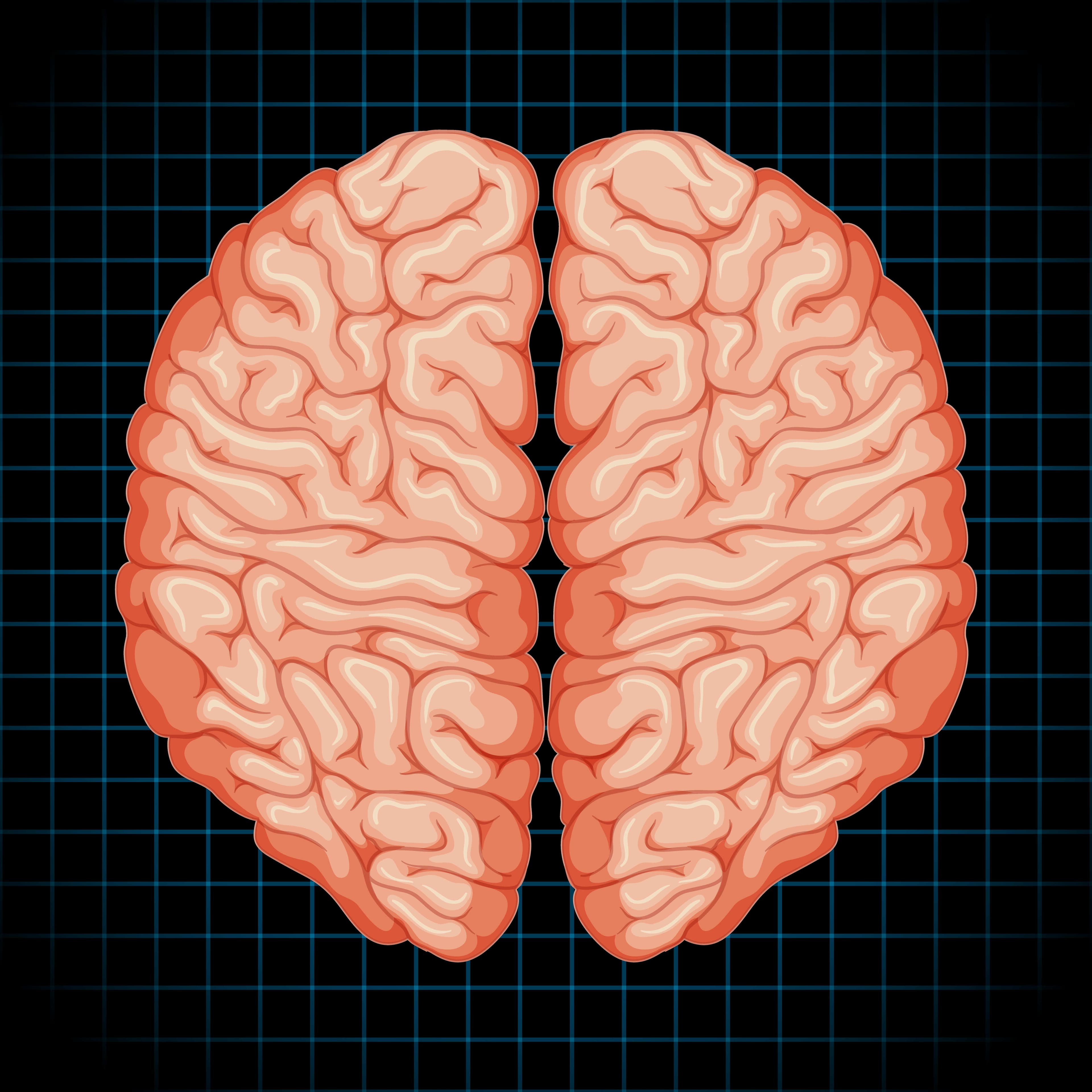 Image of Holoprosencephaly: When the Brain Does Not Divide