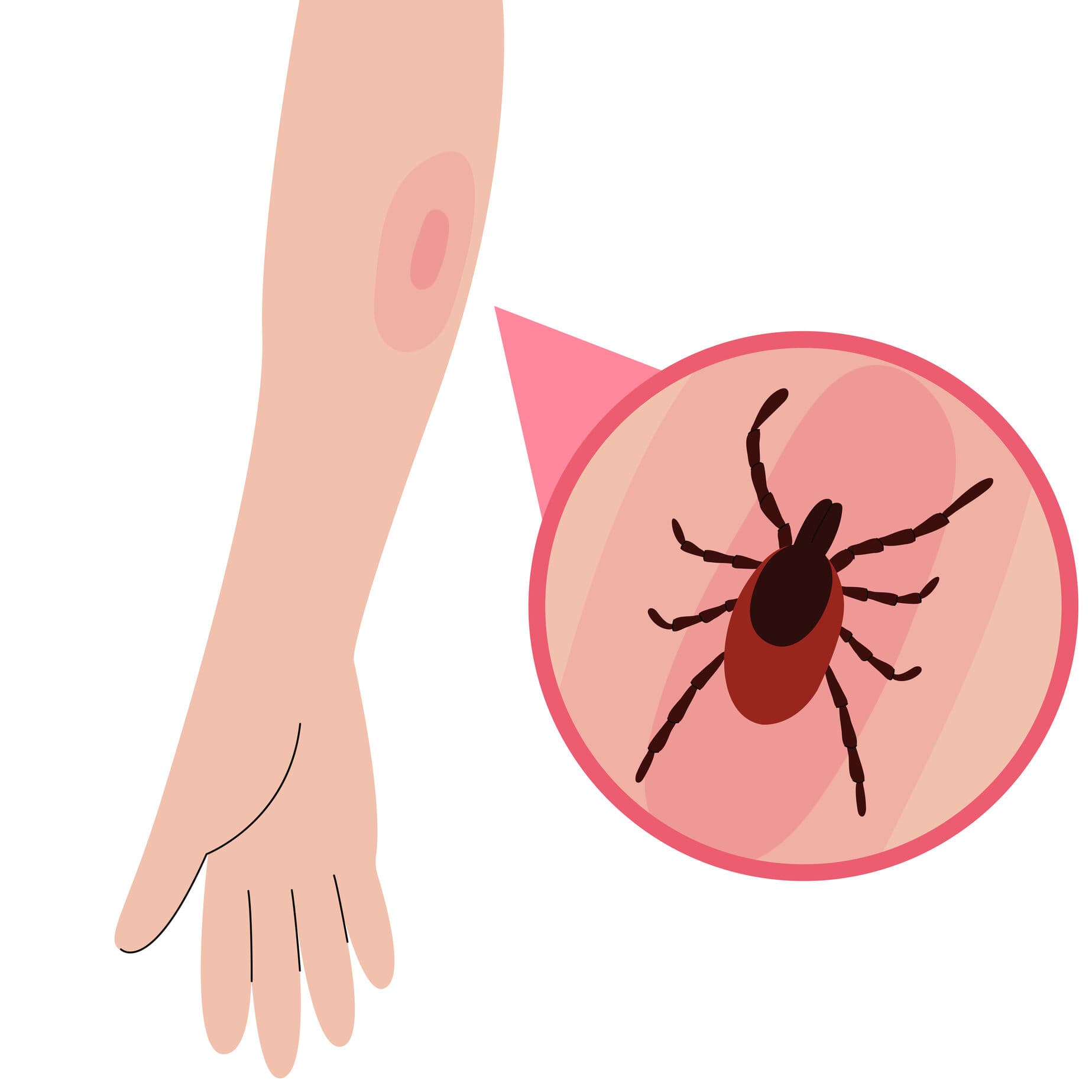 Parenting Children with Lyme Disease - 2 hour Continuing Education Course