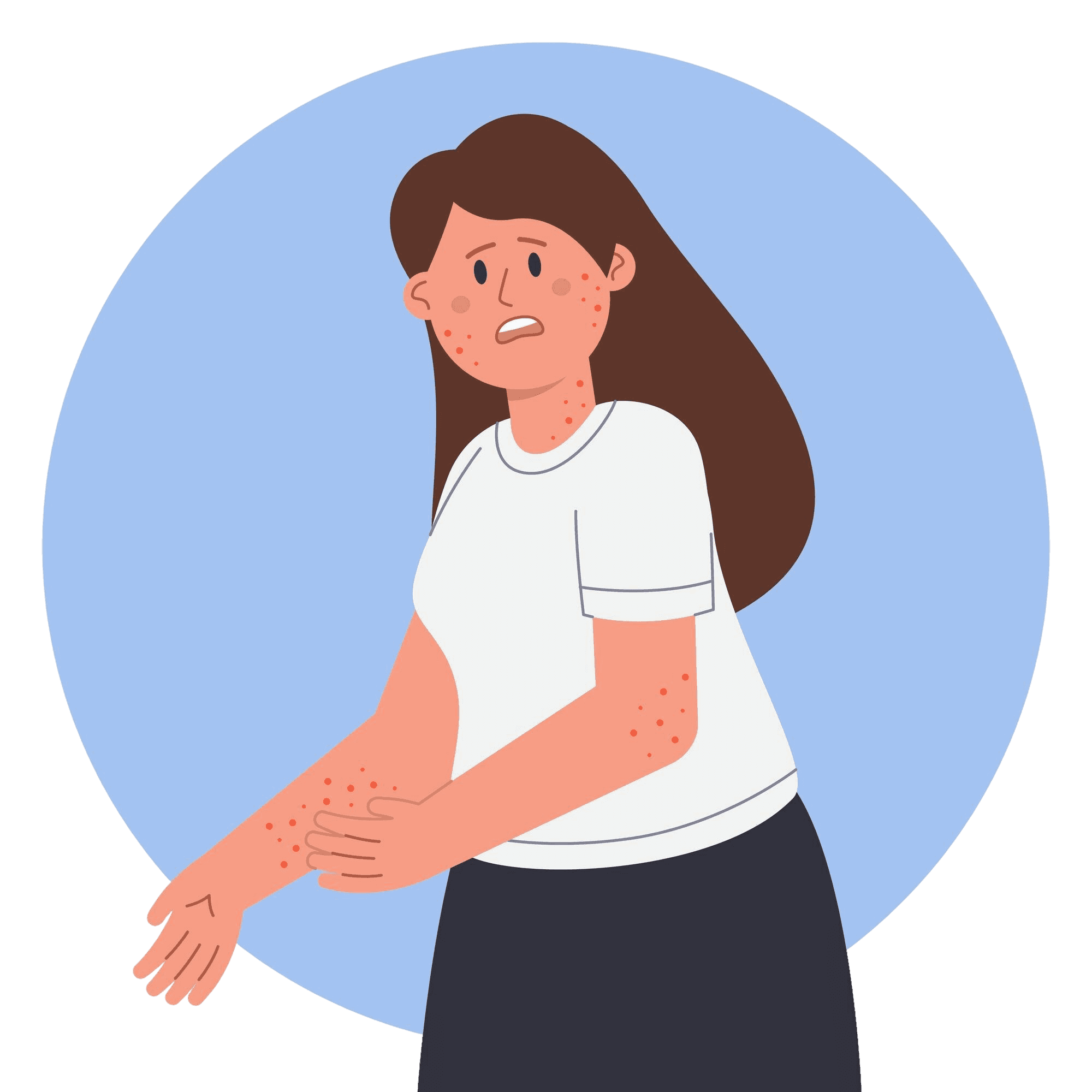 Alpha-Gal Syndrome After Tick Exposure: Recognition, Diagnosis, Management, and Prevention for Healthcare Professionals