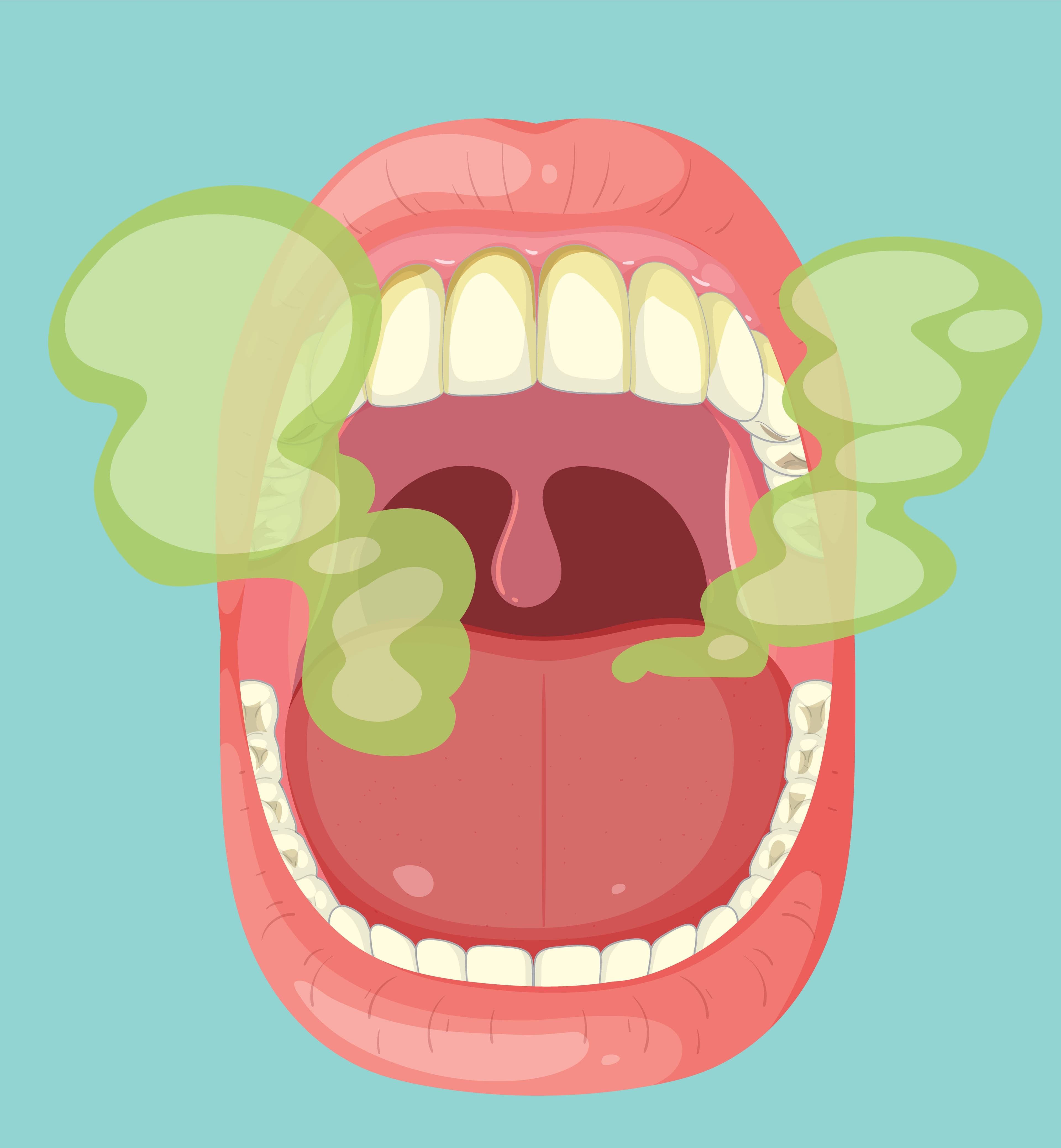 Oral Health Effects of Tobacco and Tobacco Products: Disease Recognition, Oral Cancer, and Cessation