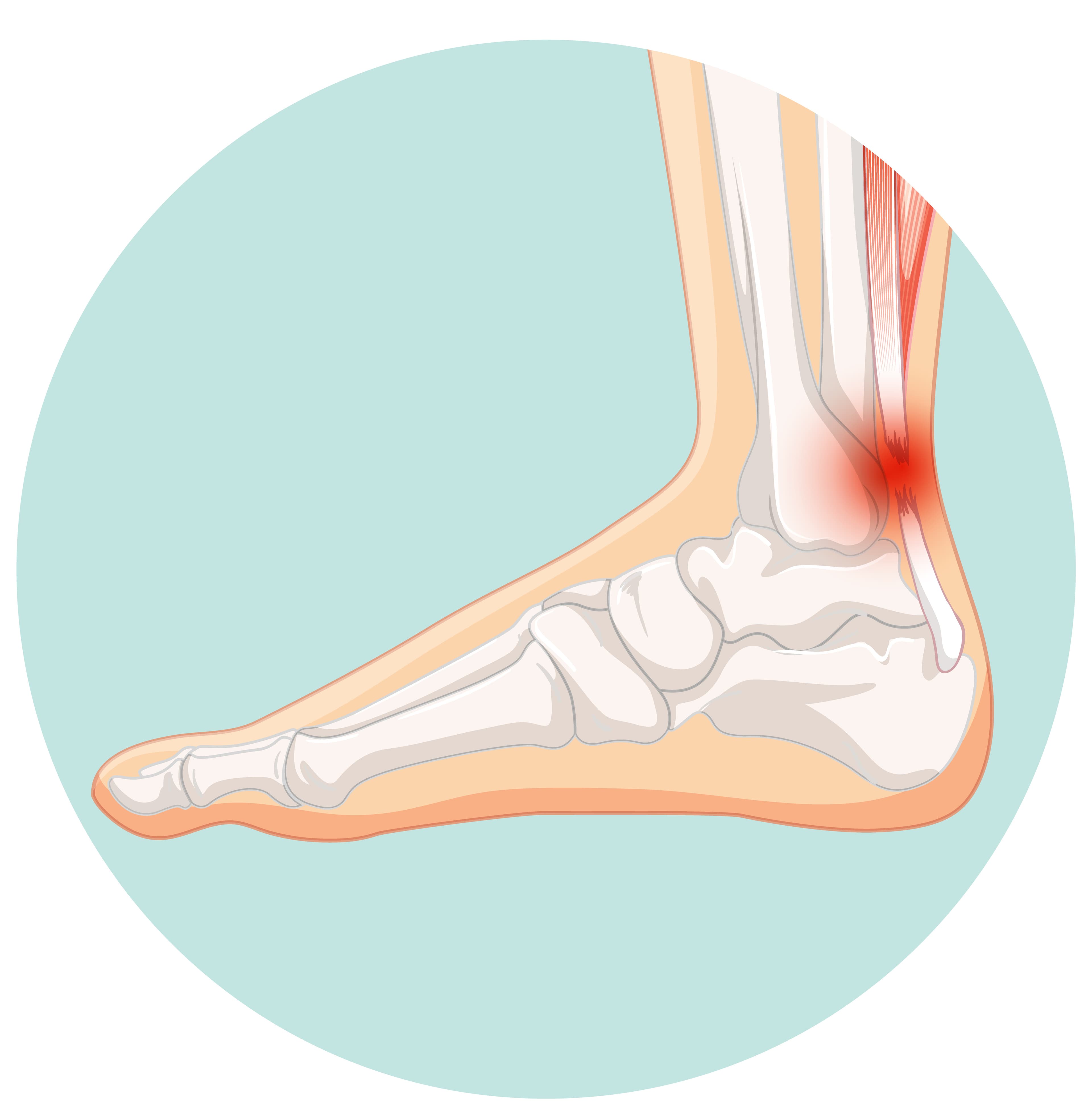 Ankle Fracture: Treatment and Management
